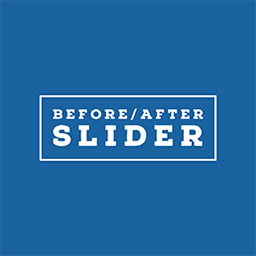 Advanced Before After Slider